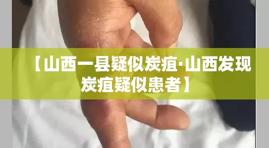 【山西一县疑似炭疽·山西发现炭疽疑似患者】 【山西一县疑似炭疽·山西发现炭疽疑似患者】